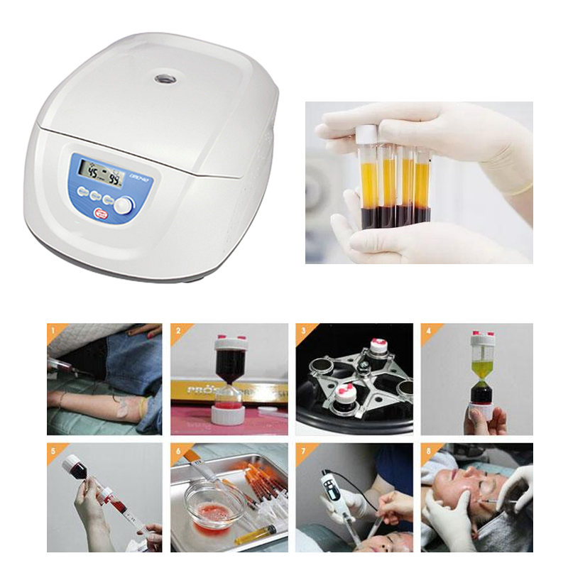 Medical Lab Center - Centrifuga medica per PRP, PRF e